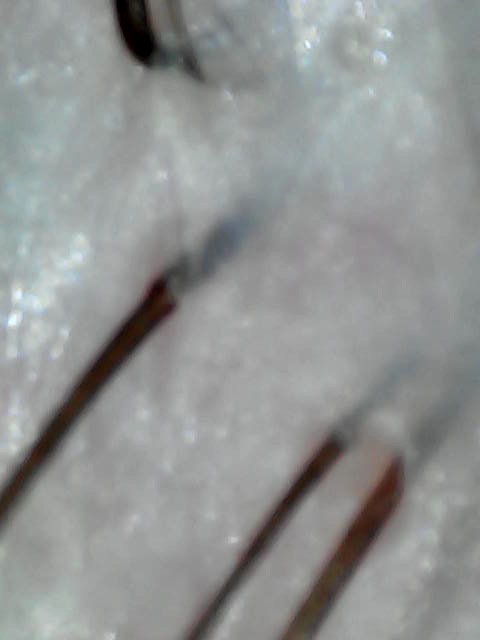 After the Scacial: clear, refreshed follicles.