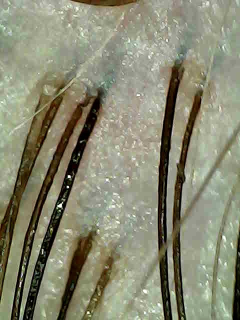 Before the Scacial: sparkling mineral and product buildup on the scalp.