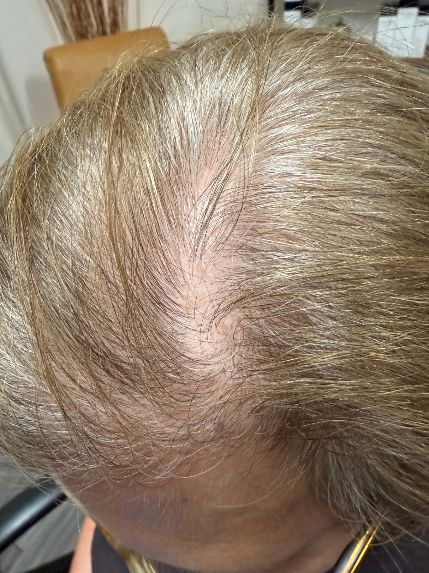 Before gray blending root touch-up on a client over 40 at Ray Rose Style, Austin, Texas.